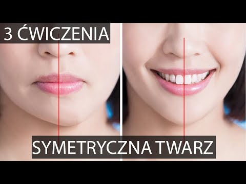 Wideo: 3 sposoby leczenia asymetrycznej twarzy