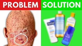 Razor Bumps: What Actually Works vs. What Wastes Money