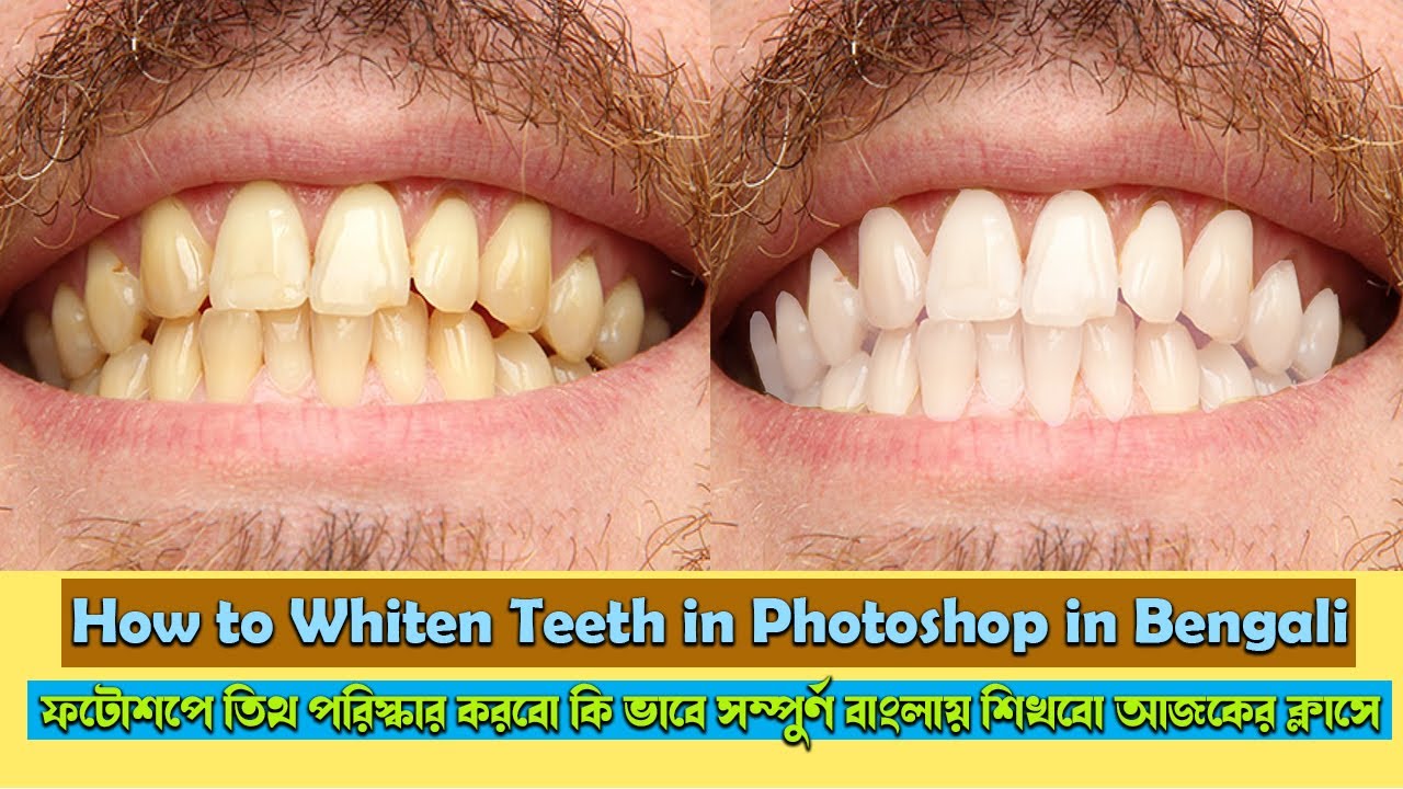 Whiten Teeth In Photoshop Whiten Teeth In 10 Seconds The BEST Way whiten-teeth-in-photoshop-whiten-teeth-in-10-seconds-the-best-way