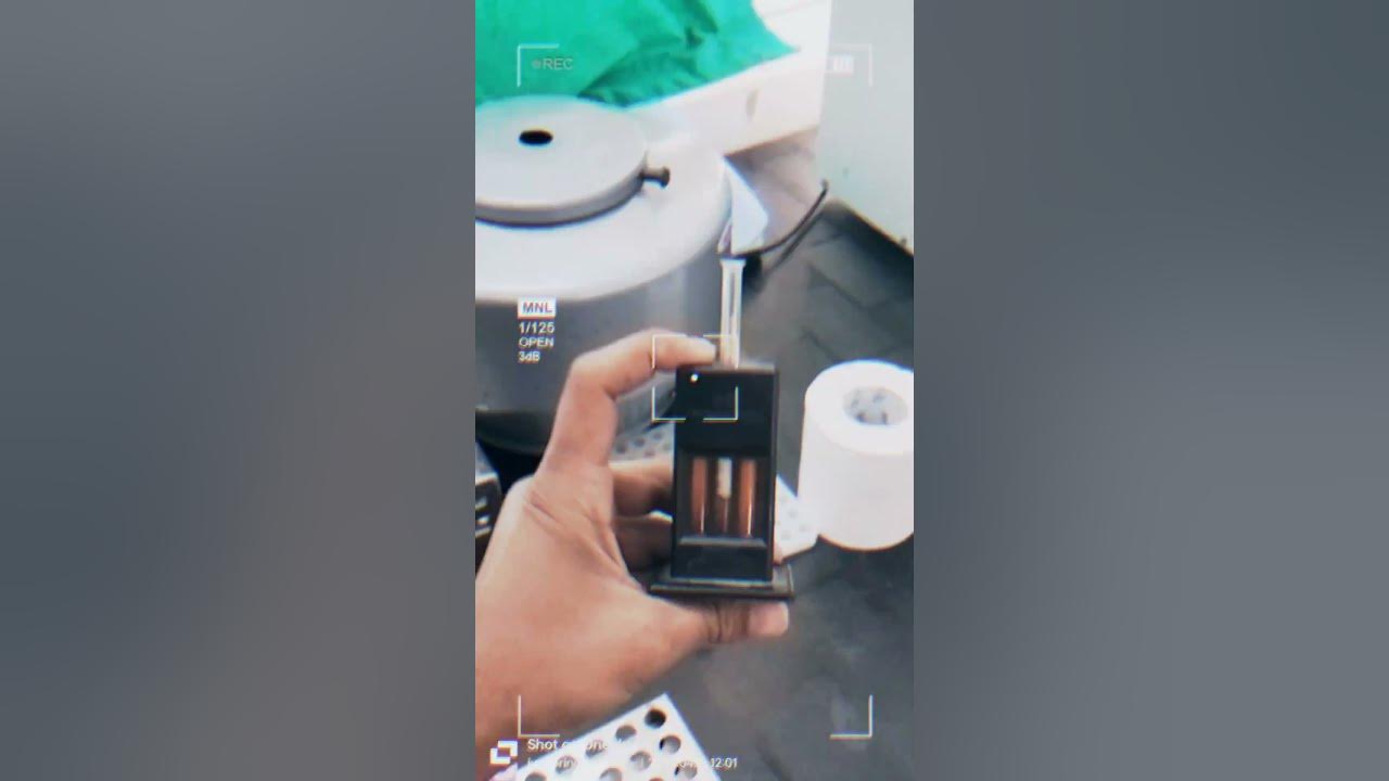 hemoglobin test #lab #doctor #labstaff #hospital #labtechnician #mbbs #labworker #hindisong #song
