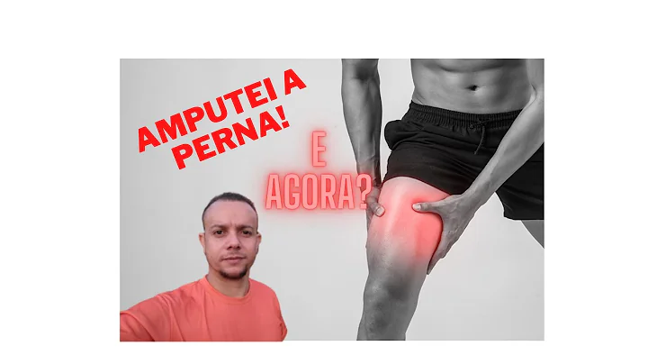 CONHEA A MINHA HISTRIA (SOBRE A AMPUTAO), PARTICIP...