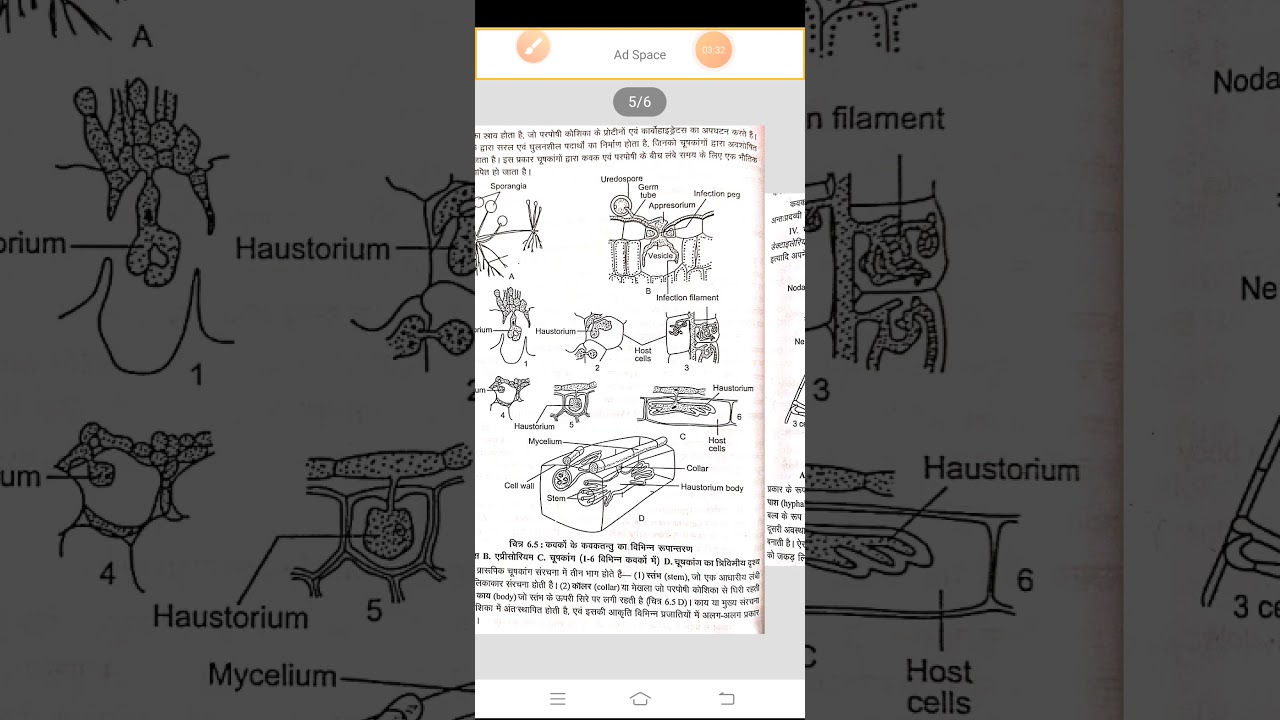 Modified hyphal structures Dr  Amit Sharma