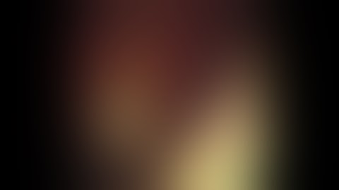 ERCP with large CBD stone removal using mechanical lithotripsy