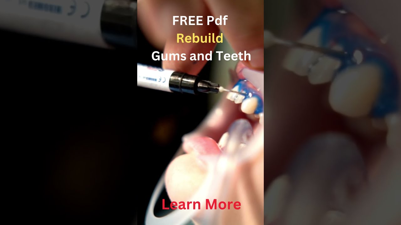 Mineral to Rebuild Gums and Teeth Dental Clinic