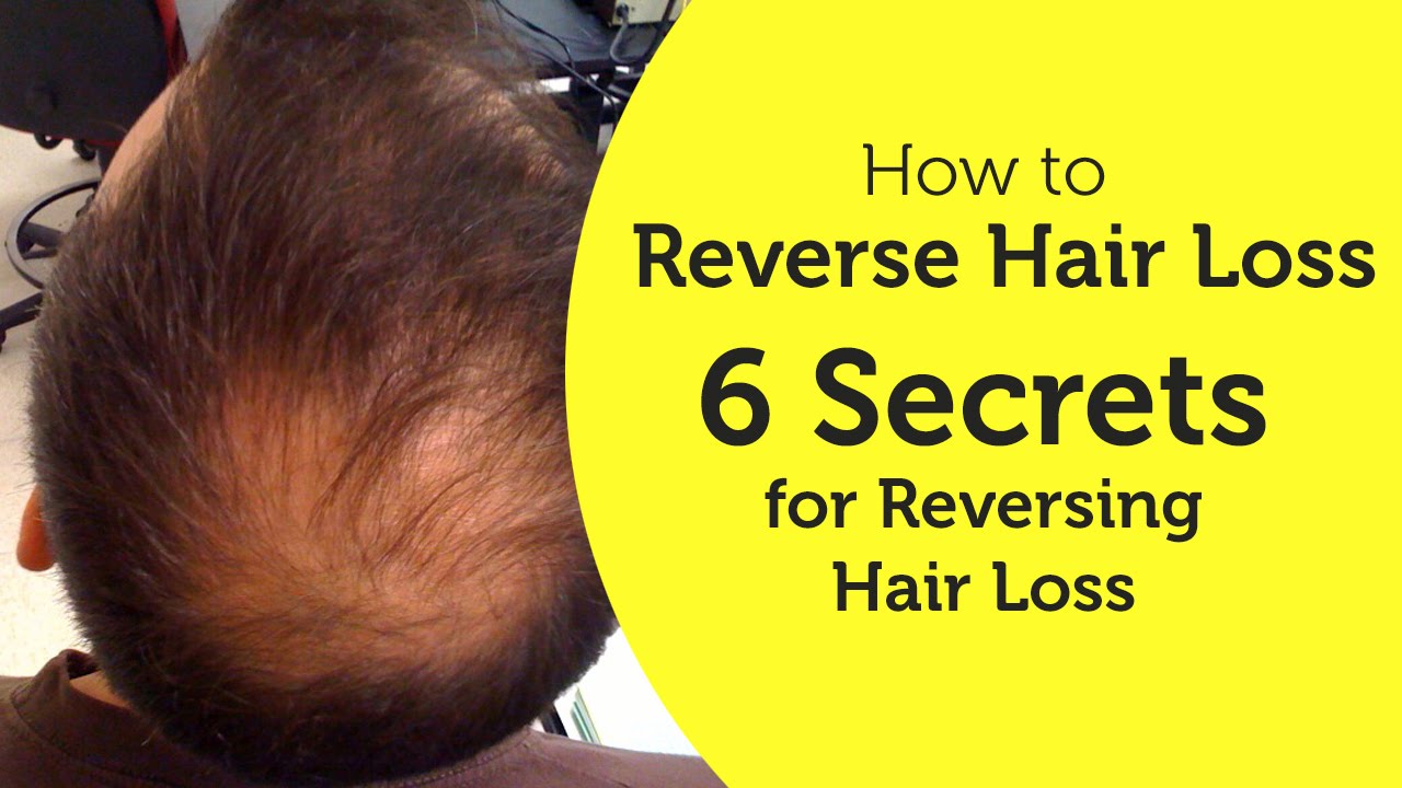 Best Can Premature Hair Loss Be Reversed with Best Haircut