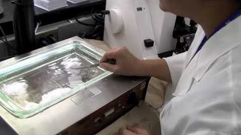 What happens to your biopsy?