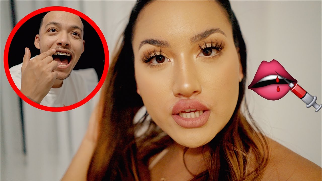 Boyfriend's Reaction To My BOTCHED LIP INJECTIONS! - YouTube