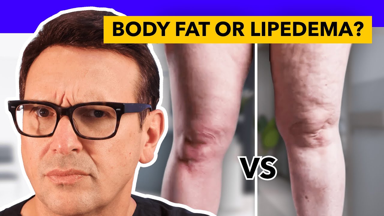 Медицинское состояние ошибочно приняли за увеличение веса.