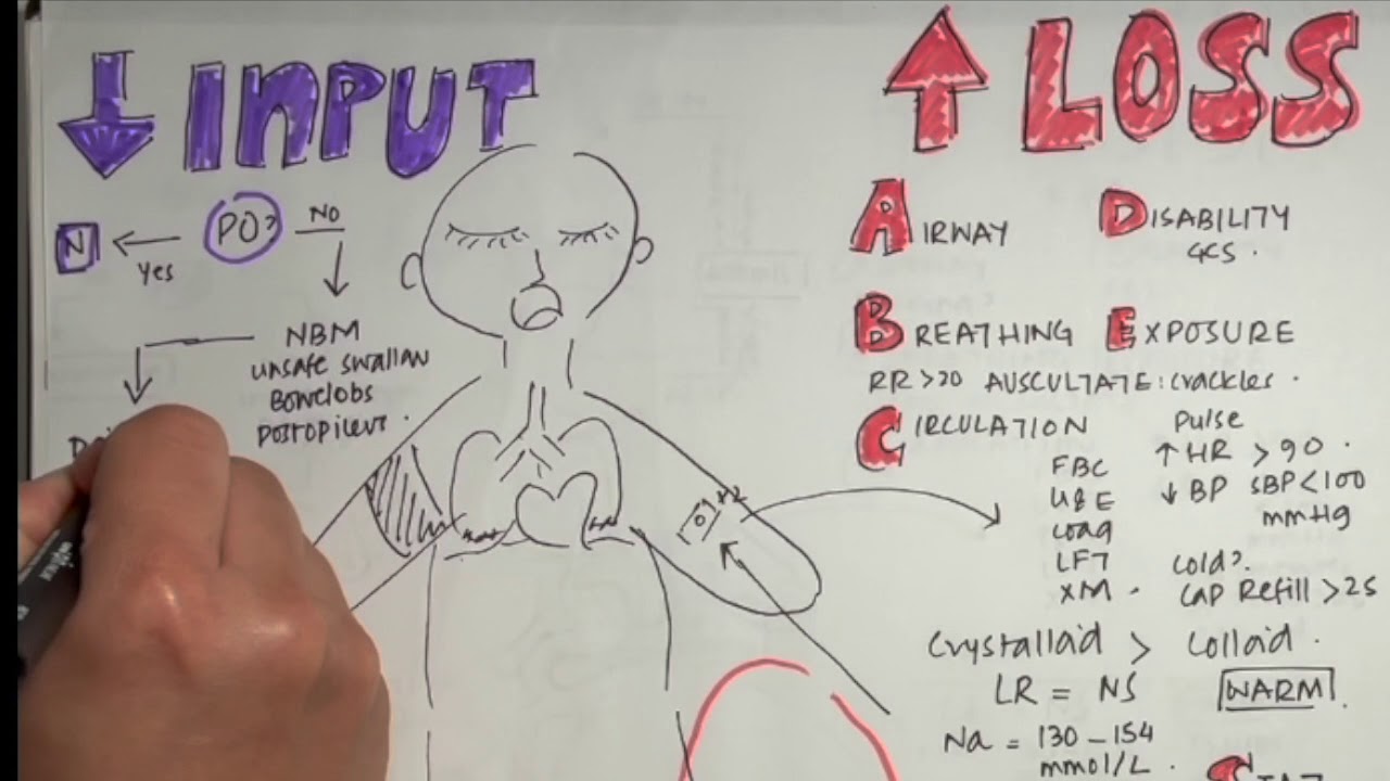 Fluid Management II Assessment, Resuscitation, Maintenance