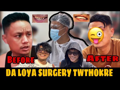 Da Loya surgery twgre || anwba salon ama 🤗🤩