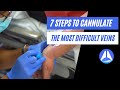 7 steps to cannulate the most difficult veins! Live demonstration