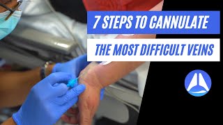 7 steps to cannulate the most difficult veins! Live demonstration