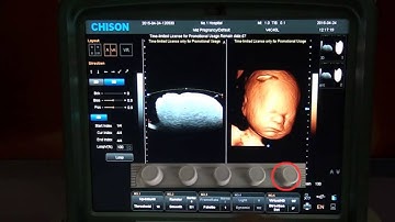 CHISON 4D Training  Video