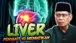 LEVER YANG MEMATIKAN