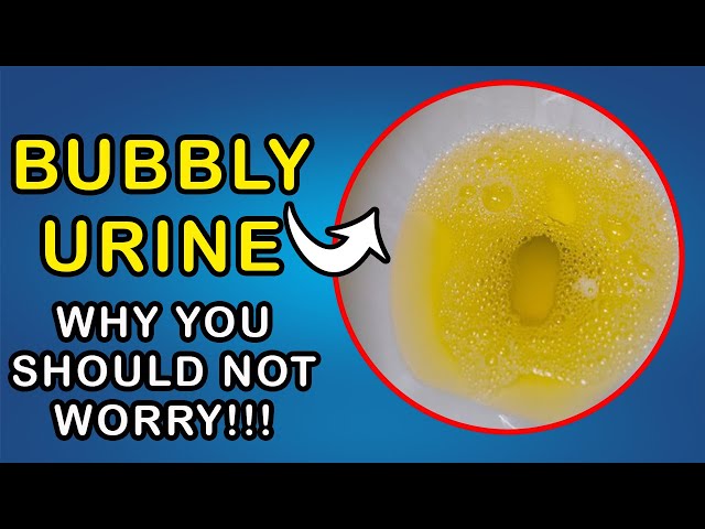 BUBBLES IN URINE Why You Don t Need To Worry jovika-vanitha-vijaykumar-bigg-boss-7