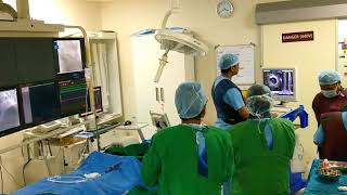 IVUS live in Cath Lab video