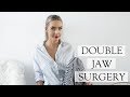 Corrective Double Jaw Surgery Experience | Post OP Swelling & Recovery