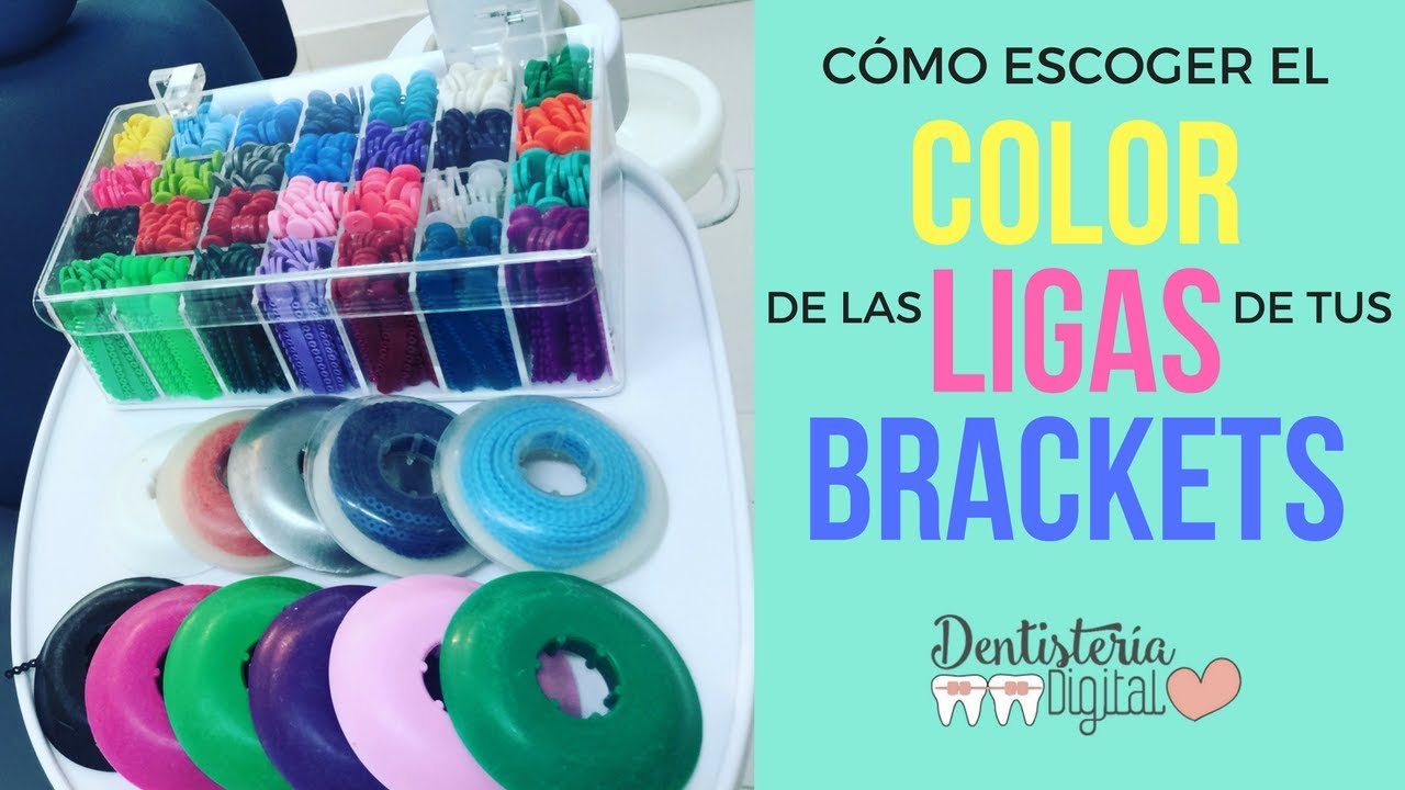 Como Escoger El Color De Las Ligas De Tus Brackets How To Choose