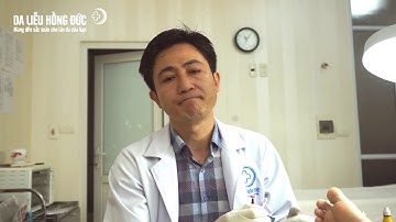 Mụn cóc - Nguyên nhân và cách điều trị