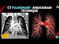 CT Pulmonary Angiogram Techniques (Part-02) | Post Processing | MIP | VRT | Pulmonary Embolism |