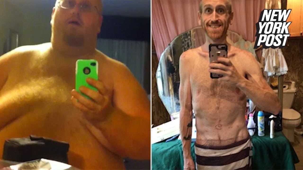 ny post mets After filming 'goodbye video' to his son, father drops 350 pounds to save his life | New York Post