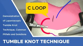 Suture Techniques And Training Series Laparoscopic Tumble Knot Technique