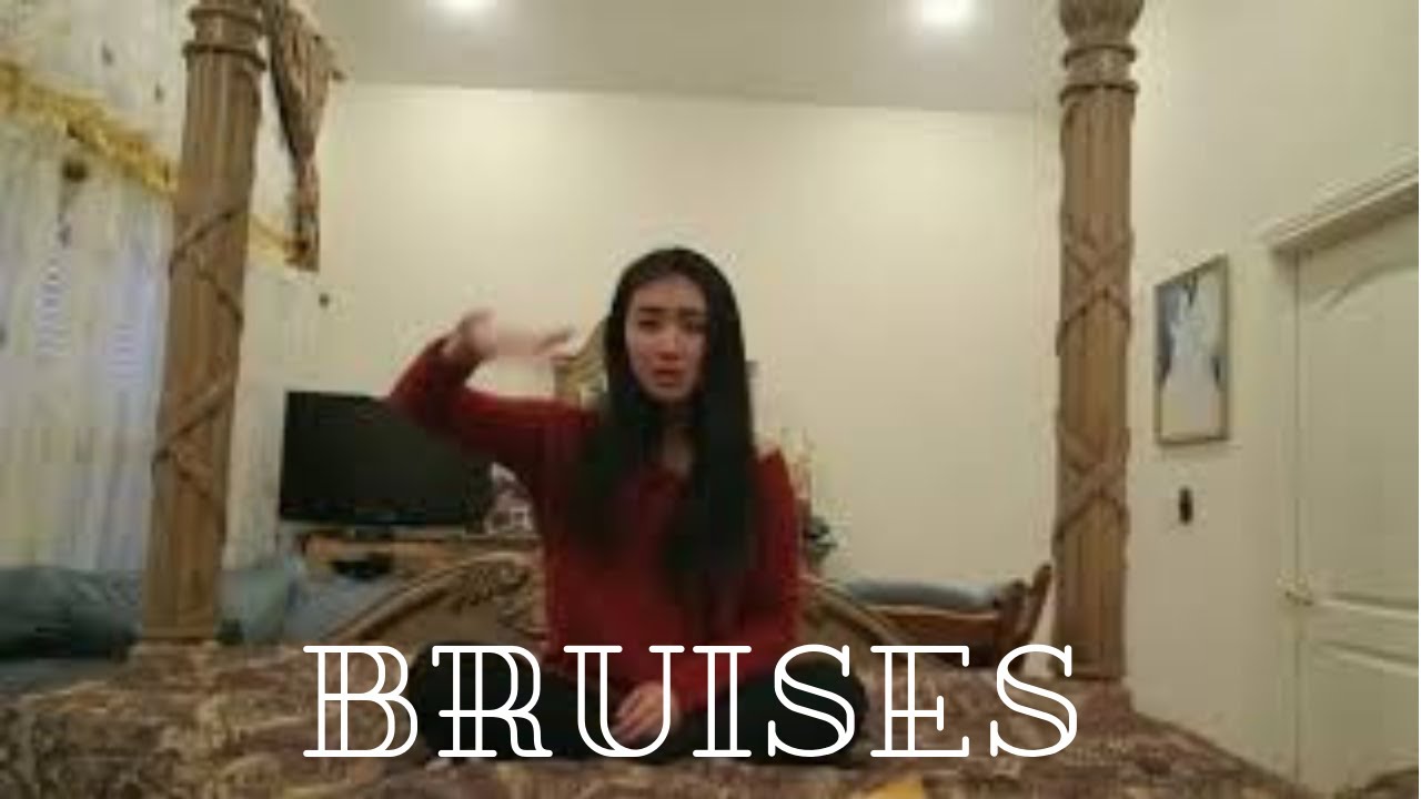 Bruises - Lewis Capaldi Sign Language