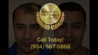 Dr. Brett Bolton Patient Amir MaxHarvest™ Plus Hair Transplant