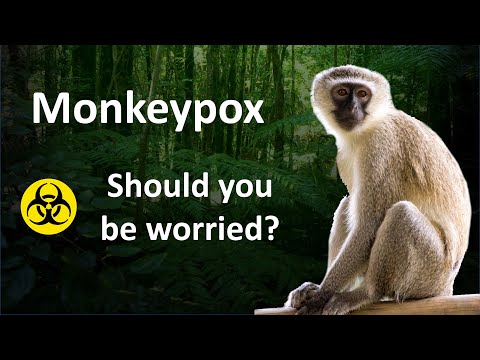 Monkeypox: Should you be worried?