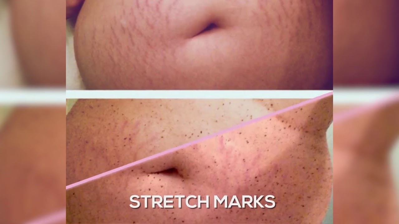 Bodyblendz Coffee Body Scrubs - The Real Deal