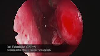 Eduardo Couto-58