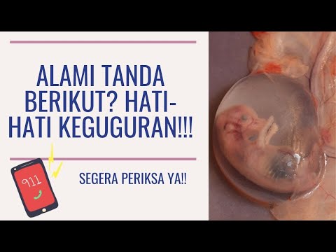 TANDA-TANDA KEGUGURAN, WAJIB PERIKSA!