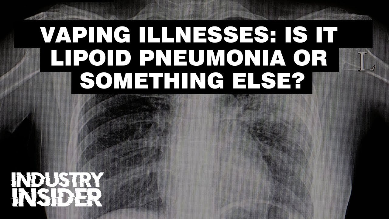 Industry Insider Vaping Illnesses Is It Lipoid Pneumonia Or