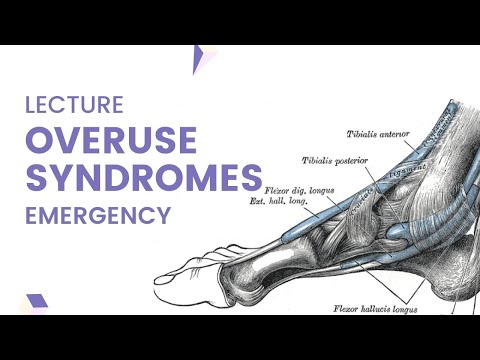 Overuse Syndrome - Detailed explanation