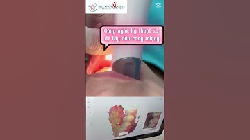 Scan 3D trong miệng – Công nghệ tiên tiến cho điều trị nha khoa! #nhakhoamarina #dentalclinic