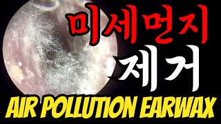 EP.172 미세먼지 제거 (AIR POLLUTION EARWAX)