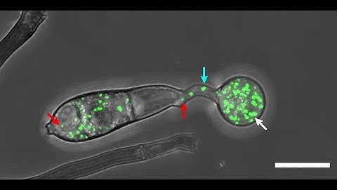 How to add arrow to image in ImageJ (arrow annotation)