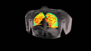 3D Dynamic OE-MRI Net Worth