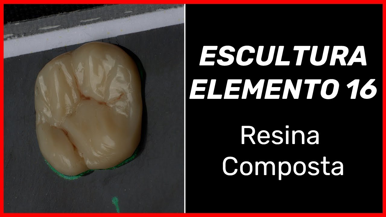 Técnica de treinamento em resina composta ELEMENTO 16