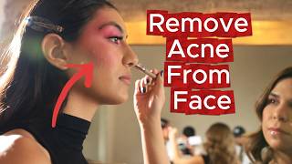 How to Remove Pimples & Acne in CapCut | Easy Skin Retouching screenshot 1
