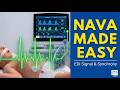 NAVA Explained: Master Neurally Adjusted Ventilatory Assist