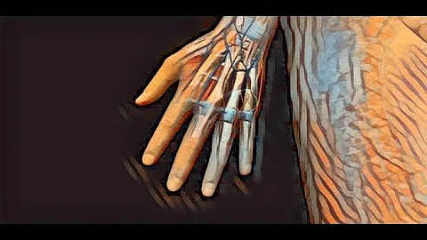 Shawn Simon asked about the hand nerves
