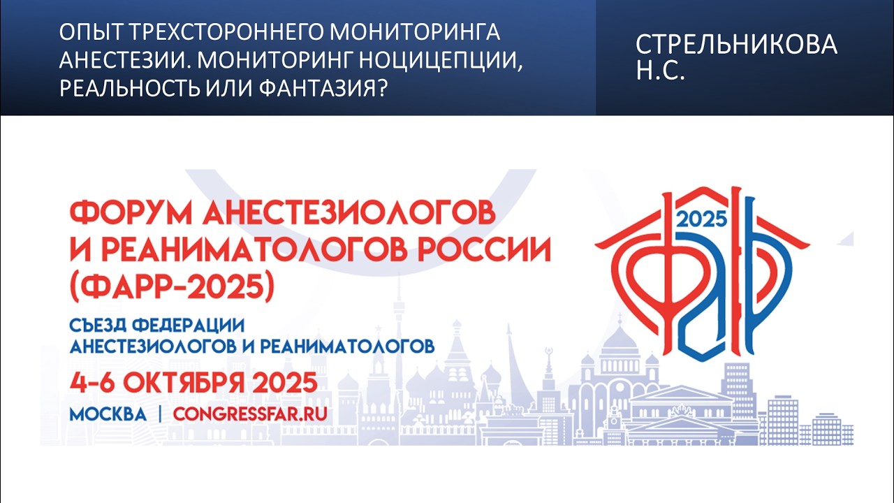 Опыт трехстороннего мониторинга анестезии. Мониторинг ноцицепции, реальность или фантазия?