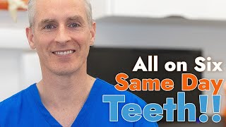 Same Day Teeth