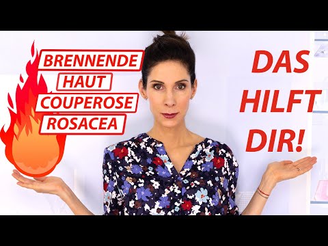 Video: Wie man Rosacea aufräumt: Können natürliche Heilmittel helfen?