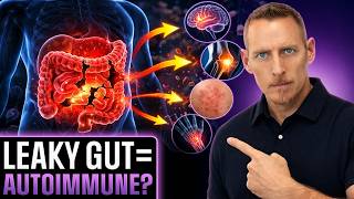 Leaky Gut: The Hidden Cause of Autoimmune Disease?
