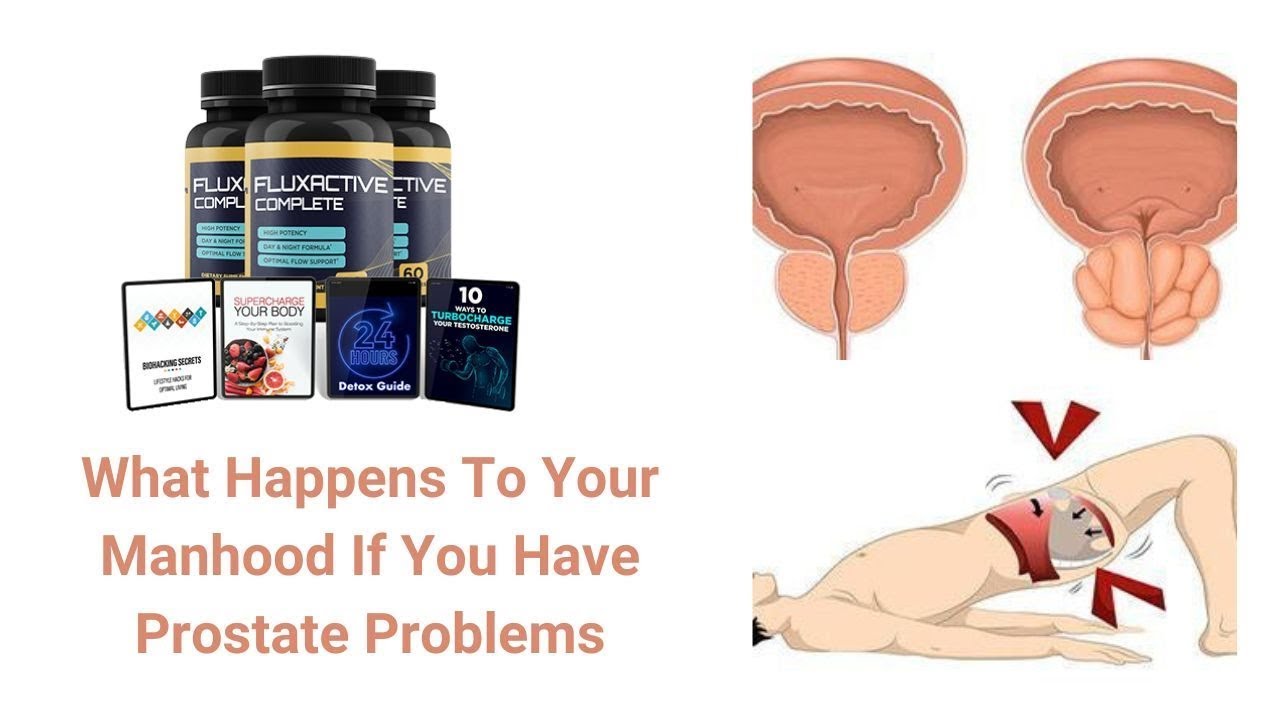 Fluxactive Complete Supplement: Pee Faster & Stronger!? Try THIS Crazy Technique