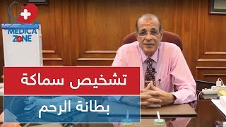 تشخيص سماكة بطانة الرحم | الدكتور اسماعيل مصطفى | MedicaZone