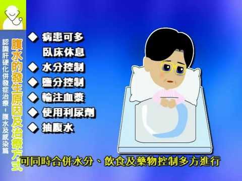 知情同意 認識肝硬化併發症治療 腹水及感染篇 國語 Youtube
