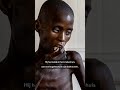 'Pijnlijke foto's, maar we moeten het Sudanese leed laten zien'